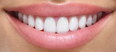 Estética dental clinica dentista