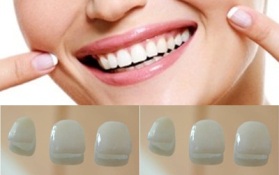 Estética dental clinica dentista